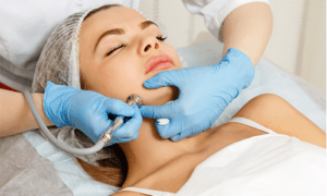 Microdermabrasion-Hydrafacial near me