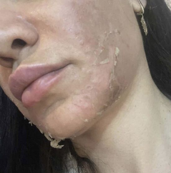 Peel green peel peelings visage