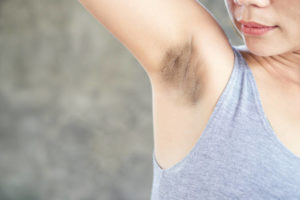 skin problem with black armpits-lightening whitening brightening