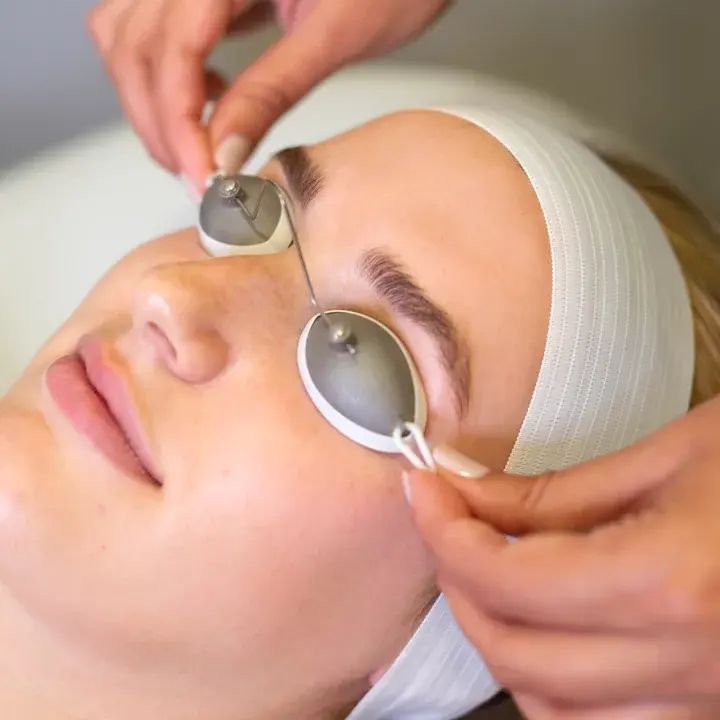 Laser facial treatment in Montreal - Skin tightening, pigmented spot removal for hyperpigention