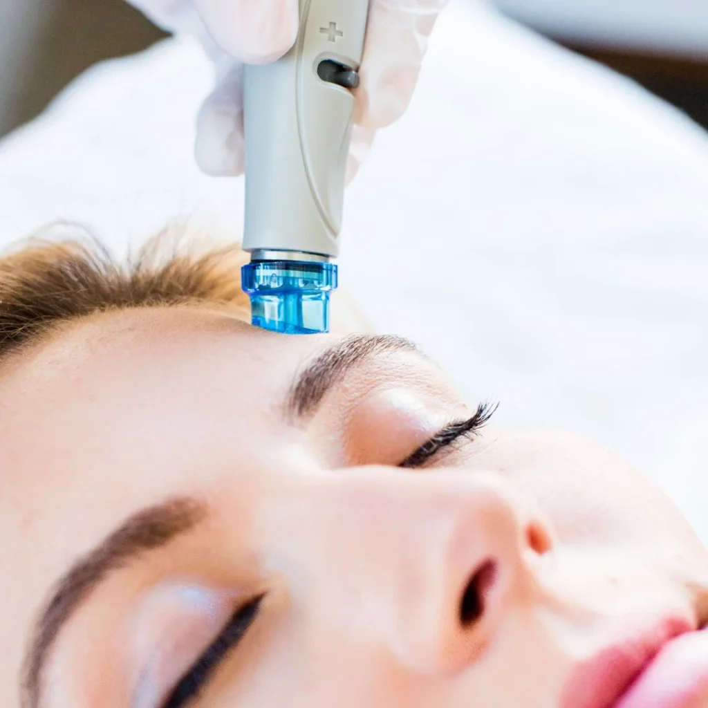 Hydrafacial In Montreal