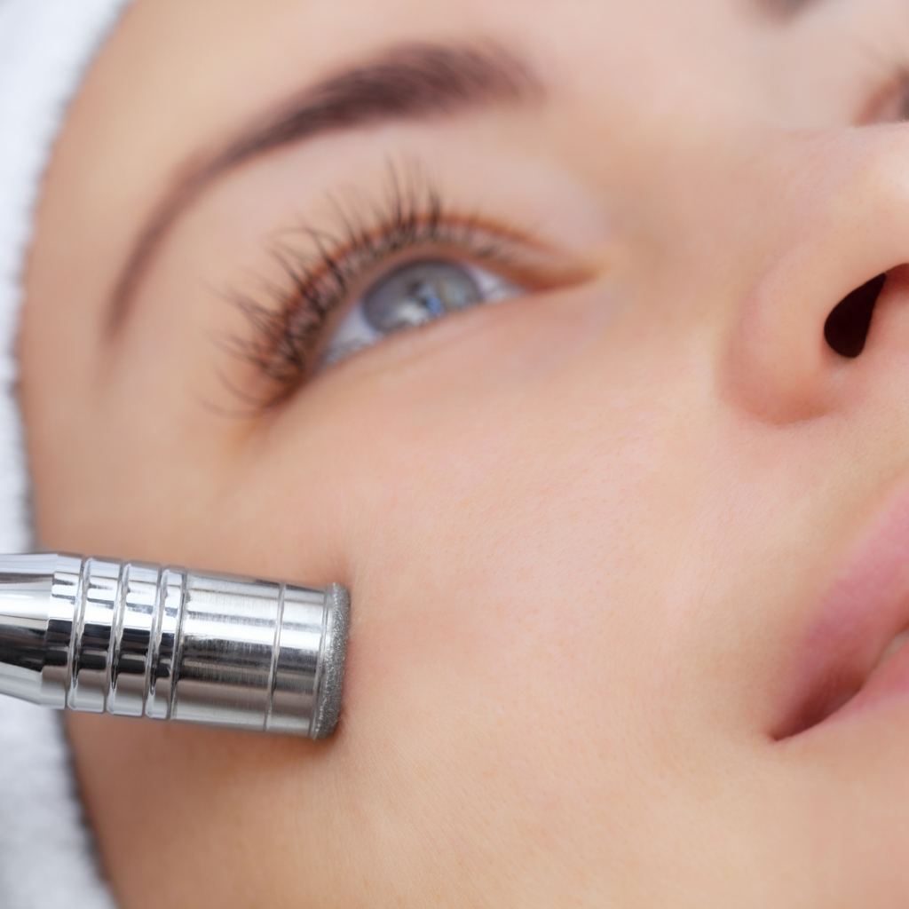 Microdermabrasion In Montreal