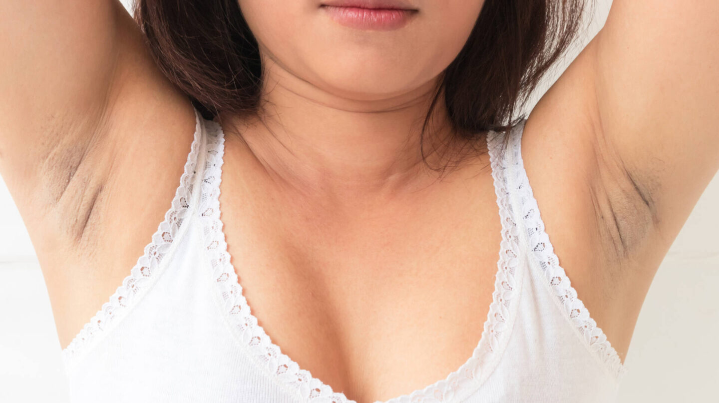 Women problem black armpit