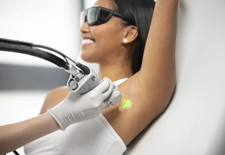 laser hair removal montreal-removal hair laser