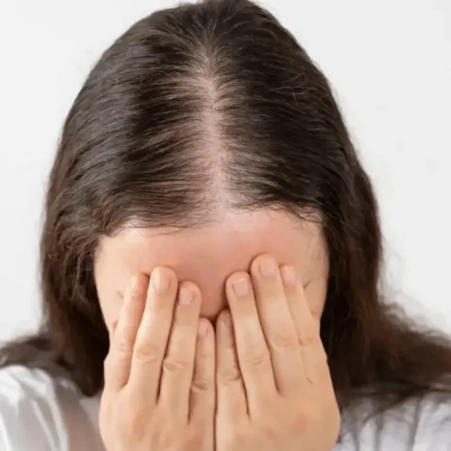 Hair Loss Womwn exosomes