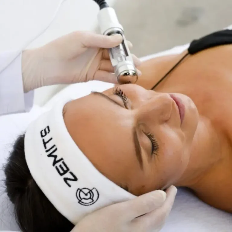 no needle mesotherapy mésothérapie sans aiguille Montreal facial treatments microdermabrasion in Montreal rosacea