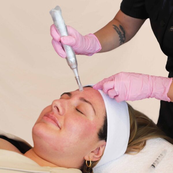 facial treatments wrinkles