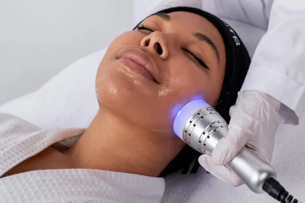 no needle mesotherapy acne Facial Near Me Microneedling near me mésothérapie sans aiguille Traitement acné
